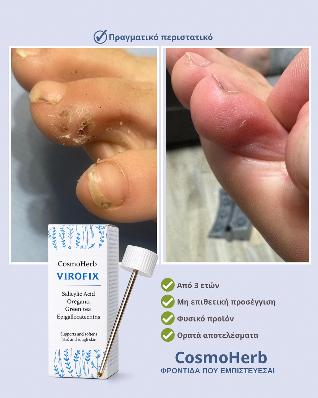 Cosmoherb VIROFIX