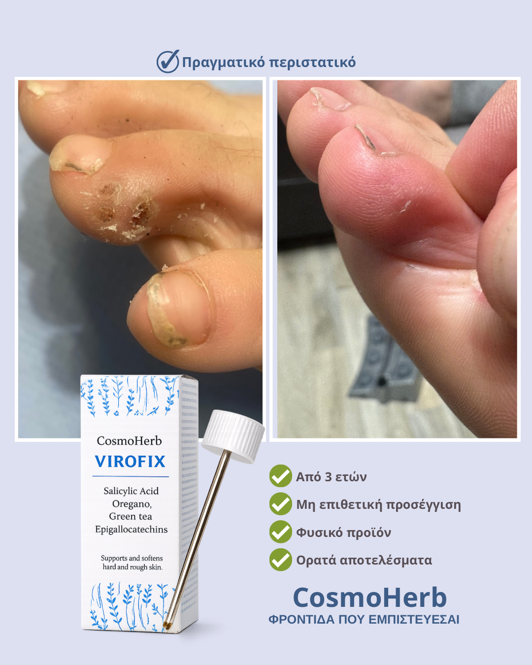 Cosmoherb VIROFIX